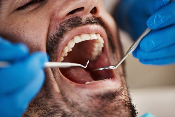 Best Urgent Dental Care for Toothache in Bullard, TX